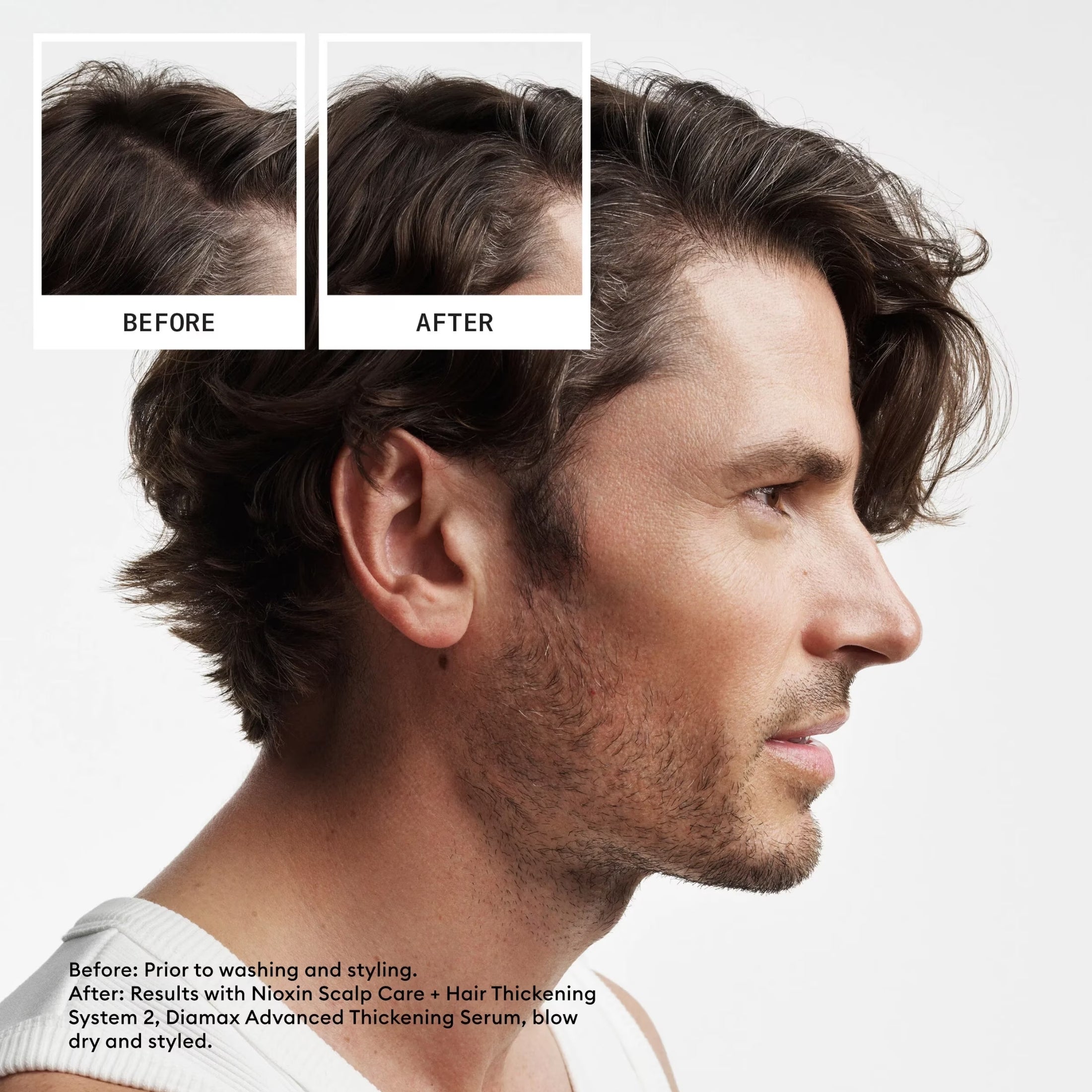 Nioxin Acondicionador Sistema #2 para Cabello Natural con Debilitamiento Avanzado 1000ml | Hidratación, Fuerza y Mayor Densidad