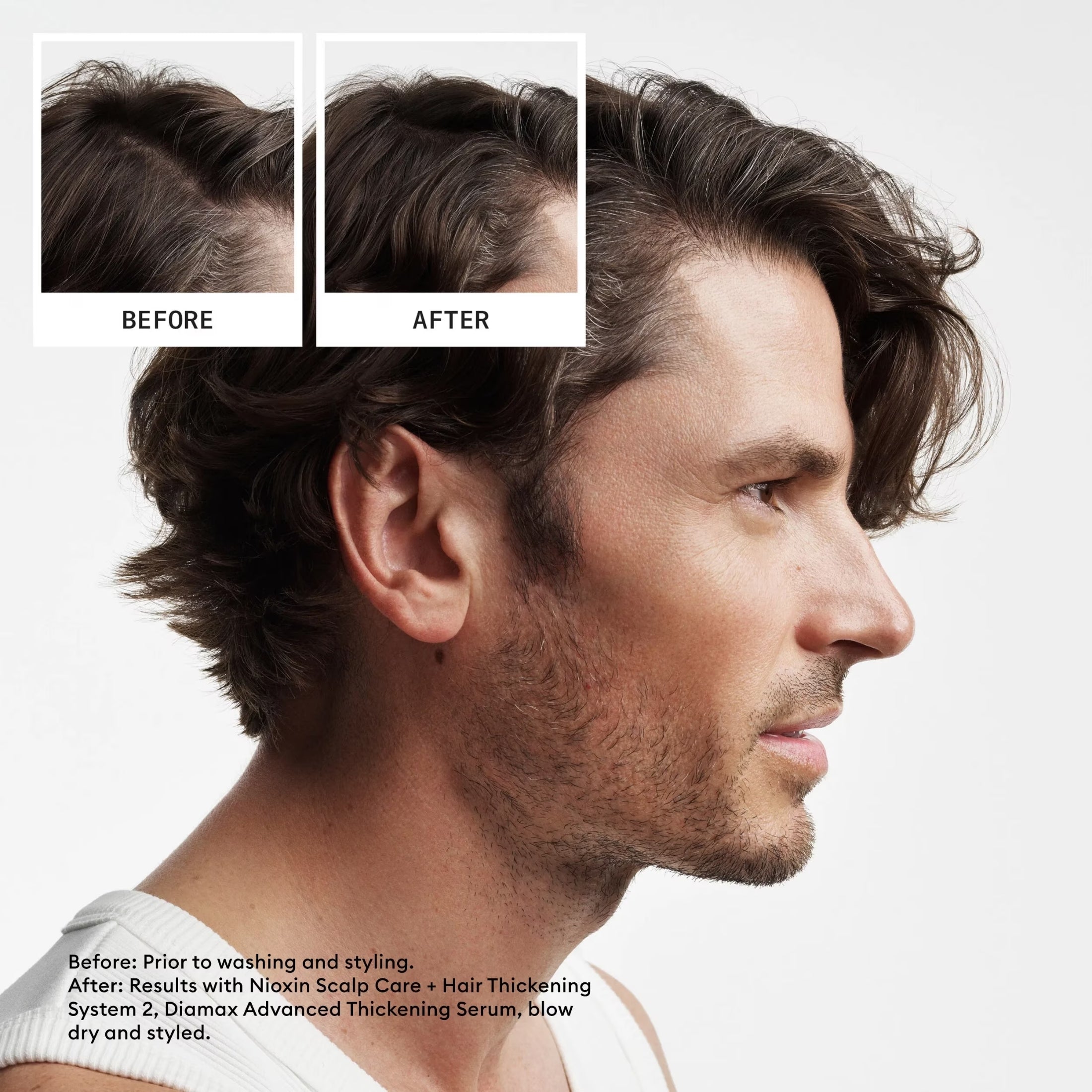 Nioxin Dúo Sistema #2 | Shampoo + Acondicionador para Cabello Natural con Debilitamiento Avanzado