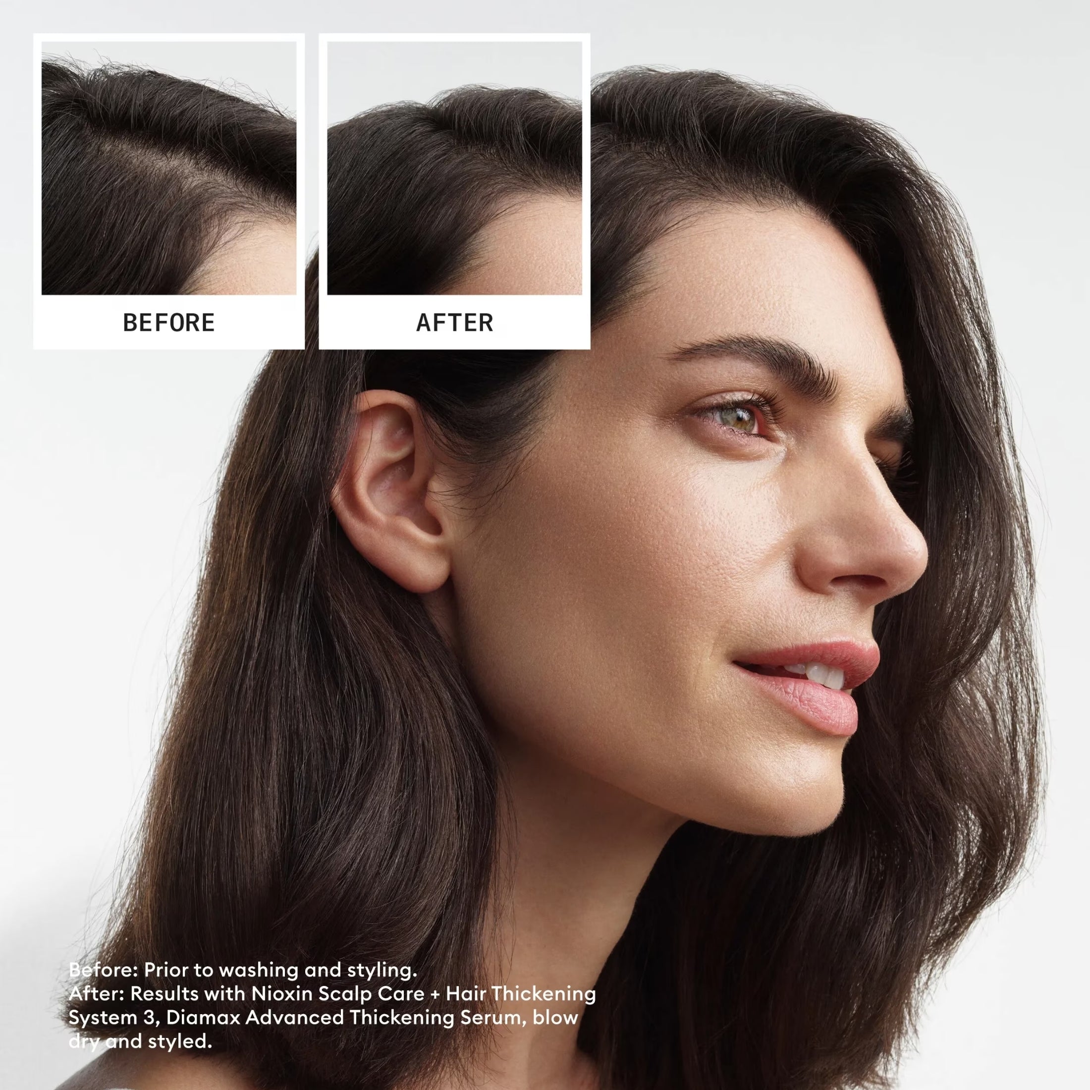 Nioxin Kit Sistema #3 1000ml | Shampoo + Acondicionador + Tratamiento para Cabello Teñido con Debilitamiento Ligero